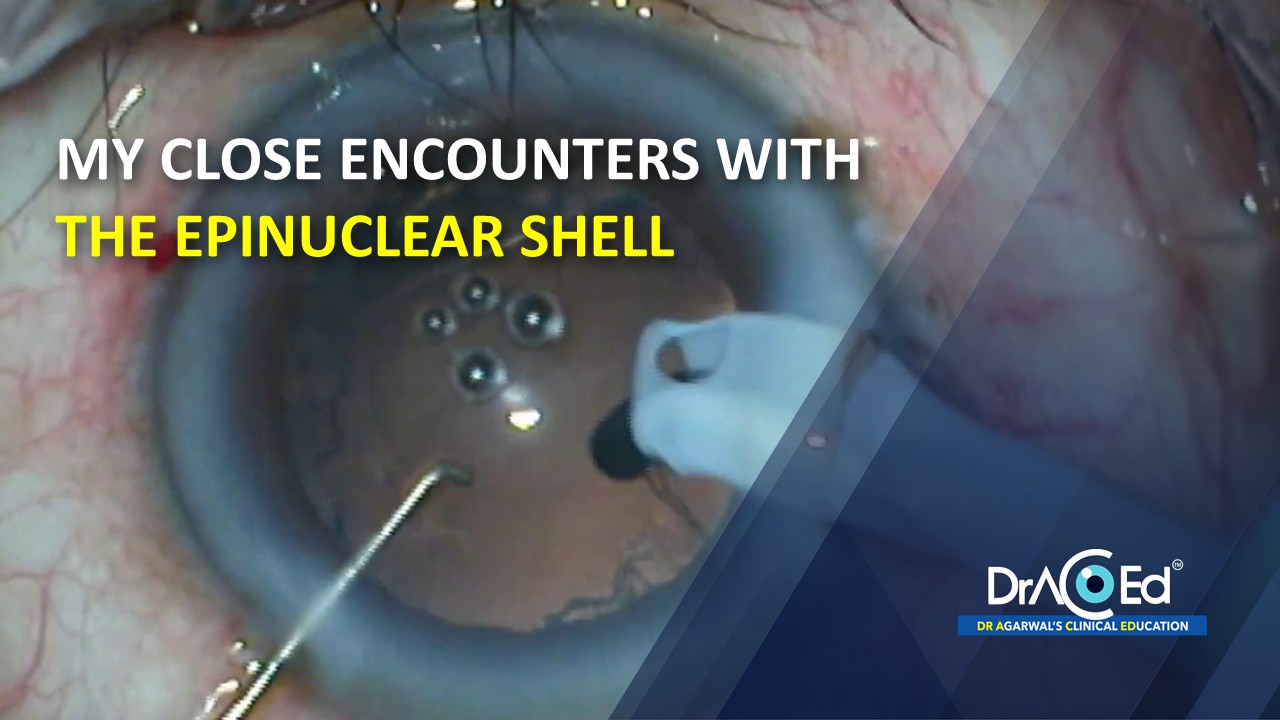 My close Encounters with the Epinuclear Shell