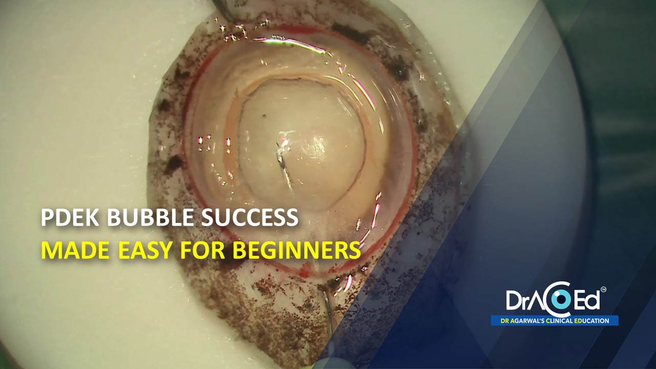 PDEK Bubble Success Made Easy for Beginners