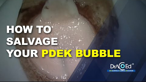PDEK How to salvage your PDEK bubble