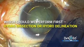 Prof.Venkatesh | Which should we perform first - Hydro dissection or Hydro delineation